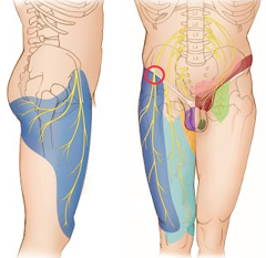 Meralgia Paresthetica: A Comprehensive Review